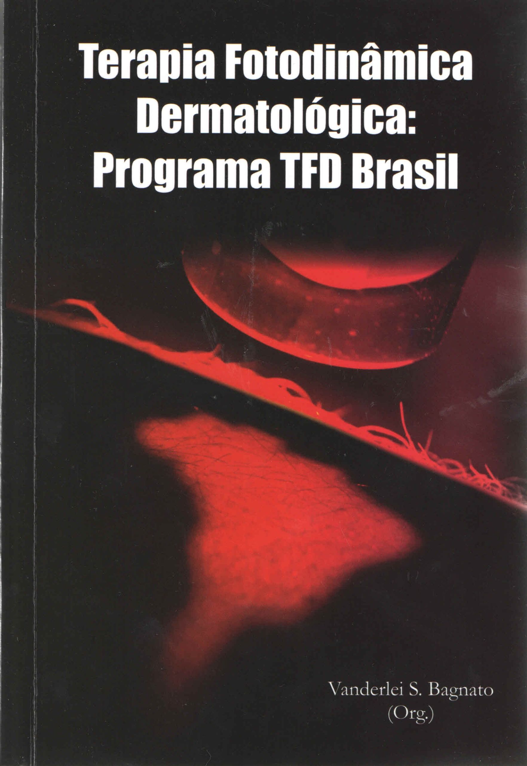 Terapia Fotodinâmica Dermatológica: Programa TFD Brasil.